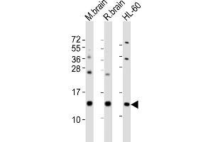 All lanes : Anti-FKBP1A Antibody (Center) at 1:2000 dilution Lane 1: mouse brain lysates Lane 2: rat brain lysates Lane 3: HL-60 whole cell lysates Lysates/proteins at 20 μg per lane. (FKBP1A anticorps  (AA 34-68))
