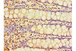 Immunohistochemistry of paraffin-embedded human rectum tissue using CHRFAM7A Antibody at a dilution of 1:100. (CHRFAM7A anticorps  (AA 1-150))