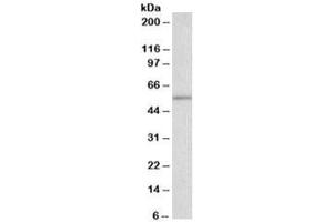 Western blot testing of Jurkat lysate with HSPC117 antibody at 0. (C22orf28 anticorps)