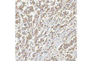 IHC analysis of TXNDC5 using anti-TXNDC5 antibody (ABIN7599699). (TXNDC5 anticorps  (AA 109-403))