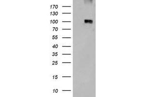 HEK293T cells were transfected with the empty vector control (Left lane) or Human LGR5 expression plasmid (Right lane) cDNA for 48 hrs and lysed. (LGR5 anticorps  (AA 250-550))