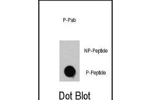 Dot blot analysis of anti-TSC2-p Phospho-specific Pab (R) on nitrocellulose membrane. (Tuberin anticorps  (pThr1462))