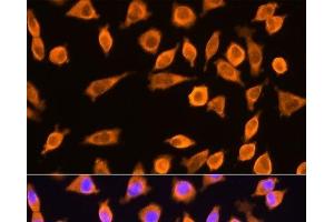 Immunofluorescence analysis of L929 cells using RPL17 Polyclonal Antibody at dilution of 1:100.