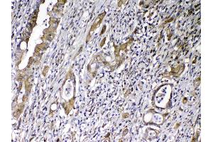 IHC analysis of Vitamin D Binding protein using anti-Vitamin D Binding protein antibody .