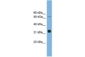 WB Suggested Anti-SLC5A4 Antibody Titration: 0. (SLC5A4 anticorps  (Middle Region))