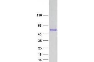 Validation with Western Blot