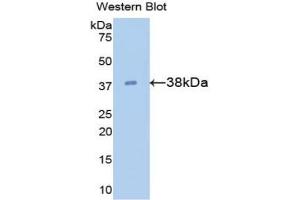 Detection of Recombinant GAL4, Human using Polyclonal Antibody to Galectin 4 (GAL4)