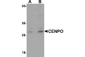 Western blot analysis of CENPO in mouse kidney tissue lysate with CENPO antibody at (A) 1 and (B) 2 µg/mL. (CENPO anticorps  (Middle Region))