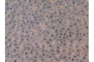 DAB staining on IHC-P; Samples: Rat Liver Tissue (TOP2 anticorps  (AA 1079-1328))