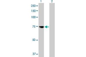 Lane 1: MSLN transfected lysate ( 67.