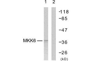 Western Blotting (WB) image for anti-Mitogen-Activated Protein Kinase Kinase 3 (MAP2K3) (Ser207) antibody (ABIN1848130) (MAP2K3 anticorps  (Ser207))