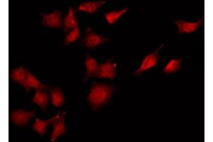 anti-CaMK2 beta/gamma antibody