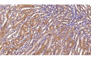Detection of APOM in Mouse Kidney Tissue using Polyclonal Antibody to Apolipoprotein M (APOM)