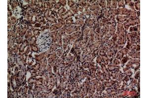 Immunohistochemistry (IHC) analysis of paraffin-embedded Rat Kidney, antibody was diluted at 1:100.