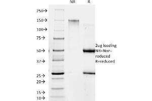 SDS-PAGE Analysis Purified RANK Giardia lamblia Mouse Monoclonal Antibody (BB1. (Giardia Lamblia anticorps)