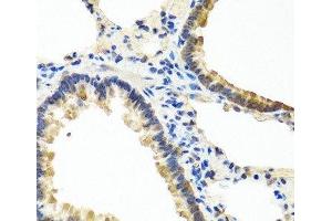 Immunohistochemistry of paraffin-embedded Rat lung using ANGPT1 Polyclonal Antibody at dilution of 1:100 (40x lens).