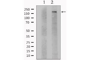 Western blot analysis of extracts from Hela, using ITGAM Antibody. (CD11b anticorps  (Internal Region))
