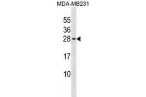 Western Blotting (WB) image for anti-Peptidyl Prolyl Cis/Trans Isomerase NIMA Interacting 4 Protein (PIN4) antibody (ABIN3000322) (PIN4 anticorps)