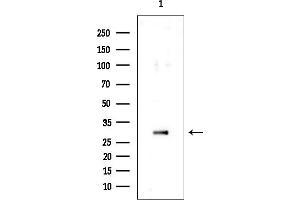 anti-4-Nitrophenylphosphatase Domain and Non-Neuronal SNAP25-Like Protein Homolog 1 (NIPSNAP1) antibody