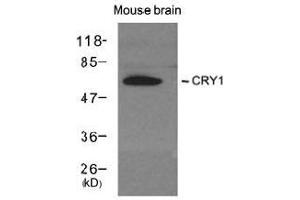 Western blot analysis of extracts from Mouse brain tissue using CRY1 antibody (CRY1 anticorps  (AA 551-555))