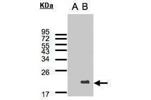 WB Image Western Blot analysis of UBE2C expression in transfected 293T cell line by UBE2C polyclonal antibody. (UBE2C anticorps)