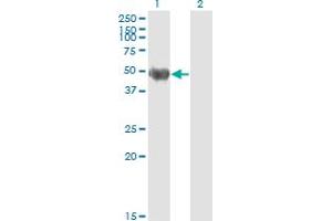 Western Blot analysis of KRT20 expression in transfected 293T cell line by KRT20 monoclonal antibody (M01), clone 2G3-1C8. (KRT20 anticorps  (AA 1-424))