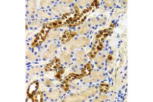 Immunohistochemistry of paraffin-embedded rat kidney using PIWIL4 antibody (ABIN5971612) at dilution of 1/100 (40x lens). (PIWIL4 anticorps)