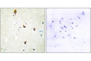 Immunohistochemistry analysis of paraffin-embedded human brain tissue, using 5-HT-2B Antibody.