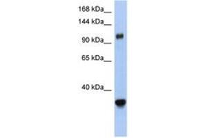 Image no. 1 for anti-Exportin 5 (XPO5) (AA 1115-1164) antibody (ABIN6743458) (XPO5 anticorps  (AA 1115-1164))