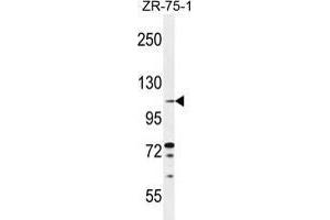 TLL2 Antibody (Center) western blot analysis in ZR-75-1 cell line lysates (35 µg/lane). (Tolloid-Like 2 anticorps  (Middle Region))