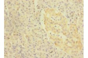 Immunohistochemistry of paraffin-embedded human pancreatic tissue using ABIN7157698 at dilution of 1:100 (KREMEN1 anticorps  (AA 180-380))
