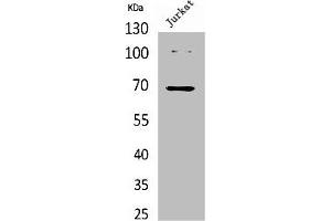 Western Blot analysis of Jurkat cells using Acetyl-Ku-70 (K542) Polyclonal Antibody.