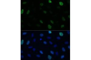 Immunofluorescence analysis of U-2 OS cells using KIFC1 Polyclonal Antibody (ABIN1680592, ABIN3017666, ABIN3017667 and ABIN6220203) at dilution of 1:100 (40x lens).