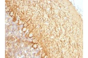 Formalin-fixed, paraffin-embedded rat cerebellum stained with Neurofilament antibody (NR-4). (Neurofilament anticorps)