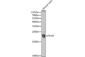 Western blot analysis of extracts of Mouse brain, using RhoB pAb  at 1:1000 dilution. (RHOB anticorps  (C-Term))