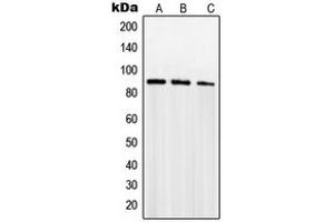 Western blot analysis of SENP5 expression in PC12 (A), Jurkat (B), NIH3T3 (C) whole cell lysates. (SENP5 anticorps  (C-Term))