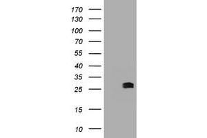 Image no. 2 for anti-B-Cell CLL/lymphoma 10 (BCL10) antibody (ABIN1496848) (BCL10 anticorps)