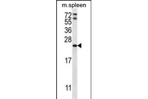 RA Antibody (C-term) 2949b western blot analysis in mouse spleen tissue lysates (35 μg/lane). (RAP1A anticorps  (C-Term))