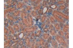 Detection of HK1 in Rat Kidney Tissue using Polyclonal Antibody to Hexokinase 1 (HK1)