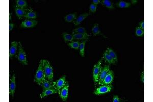 Immunofluorescent analysis of HepG2 cells using ABIN7145600 at dilution of 1:100 and Alexa Fluor 488-congugated AffiniPure Goat Anti-Rabbit IgG(H+L)