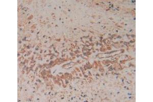 Figure. (FADD anticorps  (AA 12-206))