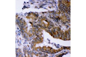 IHC analysis of LYRIC using anti-LYRIC antibody (ABIN7599627). (MTDH anticorps  (AA 101-270))