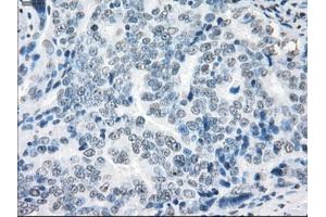 Immunohistochemical staining of paraffin-embedded colon tissue using anti-XRCC4mouse monoclonal antibody. (XRCC4 anticorps)
