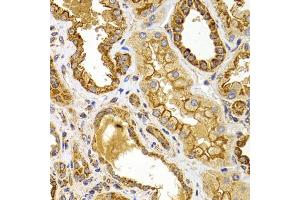 Immunohistochemistry of paraffin-embedded human kidney using BMP15 antibody (ABIN5975746) at dilution of 1/100 (40x lens). (BMP15 anticorps)