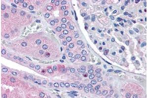 Human Kidney (formalin-fixed, paraffin-embedded) stained with RNF213 antibody ABIN290197 at 2. (RNF213 anticorps  (AA 5244-5254))