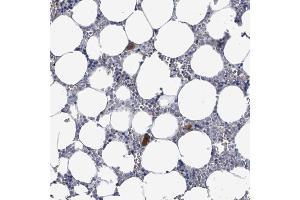 Immunohistochemical staining (Formalin-fixed paraffin-embedded sections) of human bone marrow with LILRA4 polyclonal antibody  shows strong cytoplasmic positivity in hematopoietic cells / megakaryocytes. (LILRA4 anticorps  (AA 159-211))