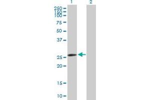 Western Blot analysis of AK2 expression in transfected 293T cell line by AK2 MaxPab polyclonal antibody. (Adenylate Kinase 2 anticorps  (AA 1-239))