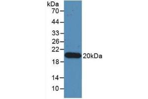 Detection of Recombinant IL17, Human using Monoclonal Antibody to Interleukin 17 (IL17) (IL-17 anticorps  (AA 20-155))