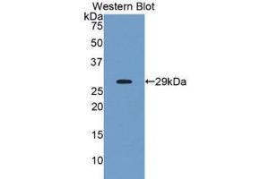 Western Blotting (WB) image for anti-Angiopoietin-Like 2 (ANGPTL2) (AA 267-493) antibody (Biotin) (ABIN1175212)