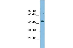 WB Suggested Anti-CCBE1 Antibody Titration: 0. (CCBE1 anticorps  (Middle Region))